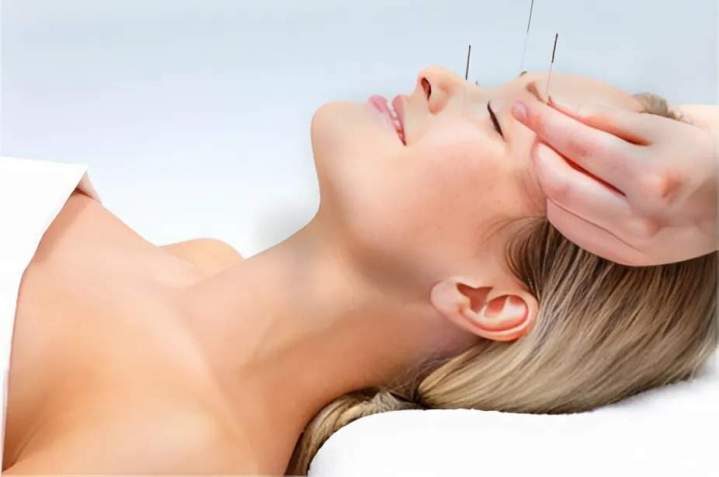 Acupuncture Coral Gables