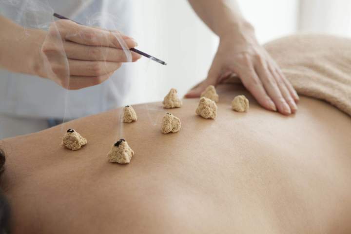Acupuncture Miami